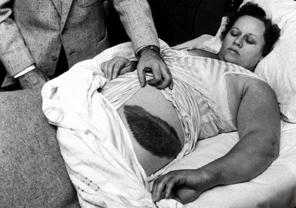 Коляска-противогаз, зимний сочинский солярий и другие редкие исторические фотографии, которые вас удивят