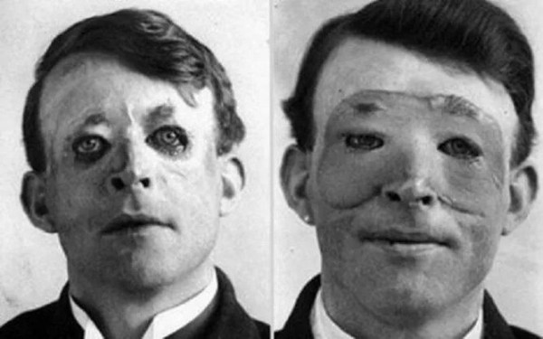 Коляска-противогаз, зимний сочинский солярий и другие редкие исторические фотографии, которые вас удивят